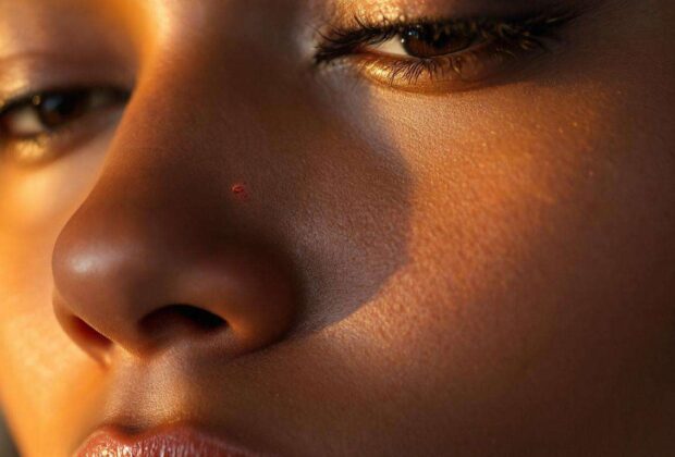 Grain de Beauté qui Saigne : que Faire ?