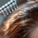 Comment le dermaroller favorise la santé des cheveux